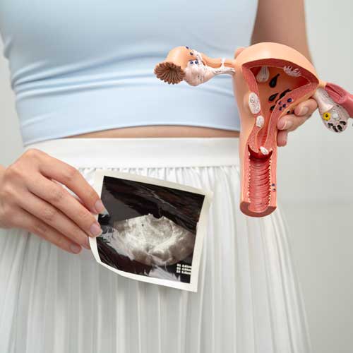 Pregnancy or hysterectomy